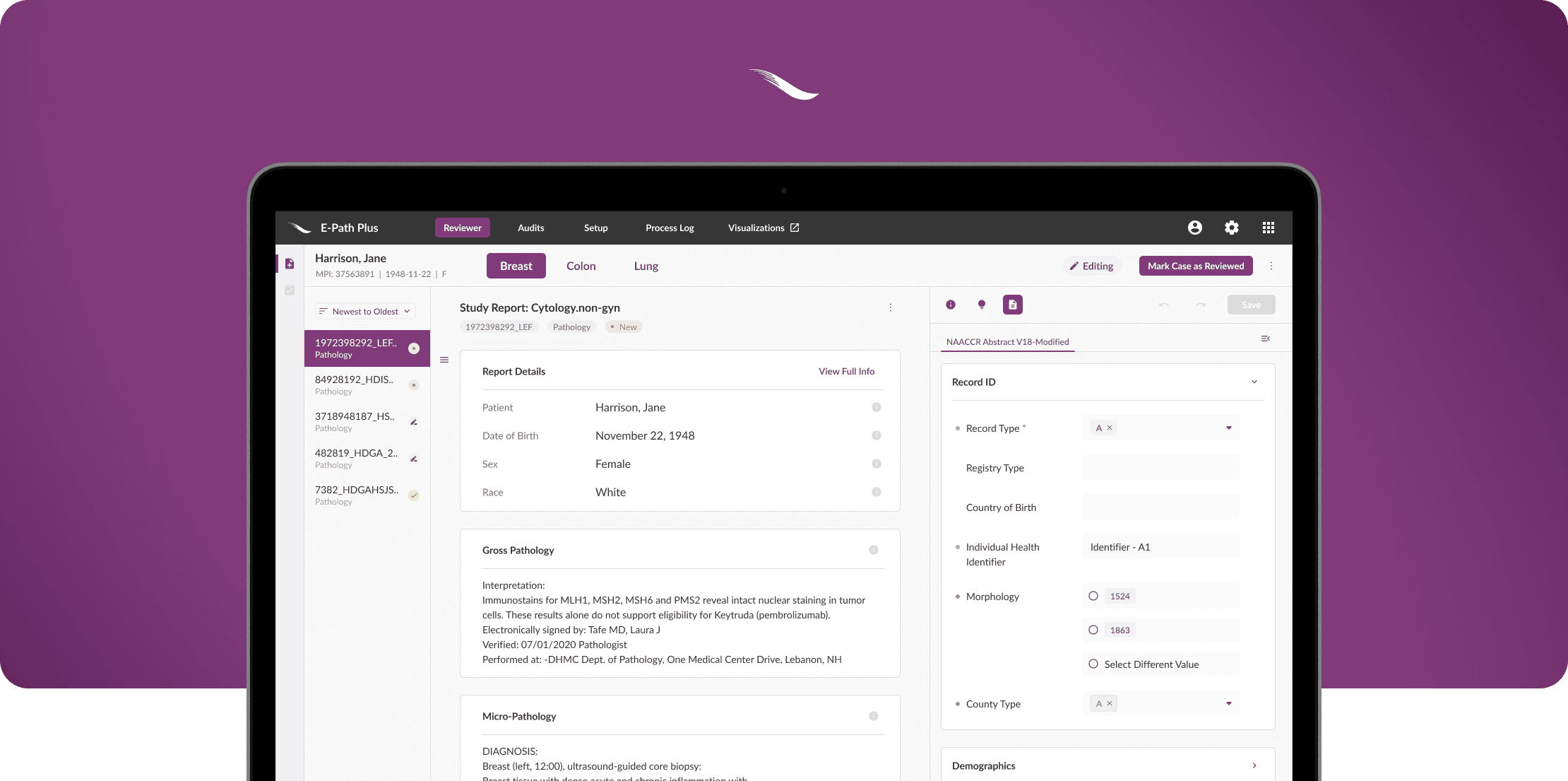 E-Path Plus — Oncology-focused AI for cancer-registry abstraction